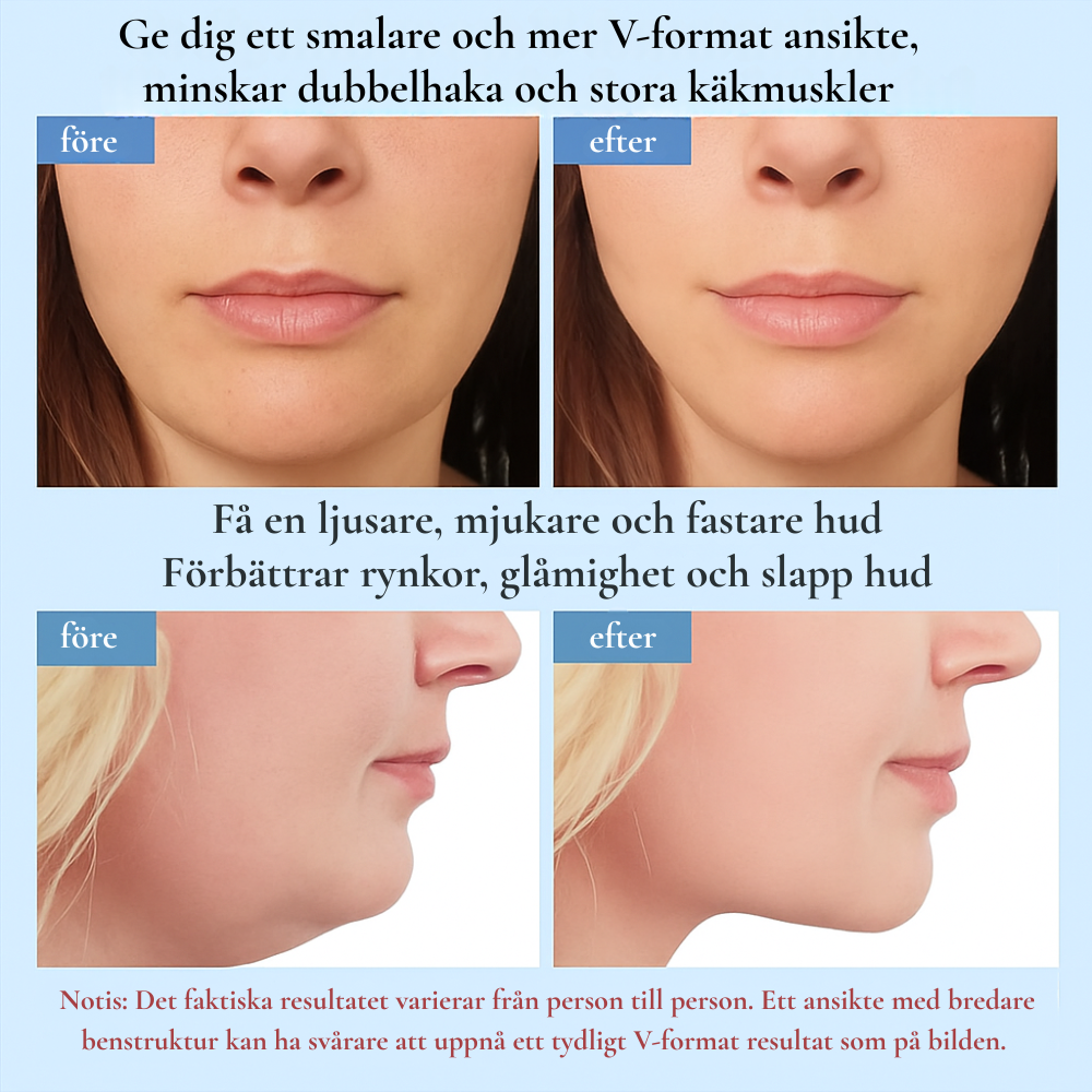 KYRA – Ansiktsapparat med LED-ljus och EMS-lyft